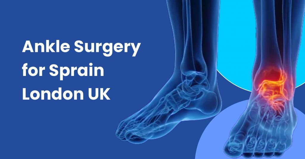 Ankle Surgery for Sprain London UK