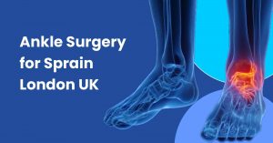 Ankle Surgery for Sprain London UK