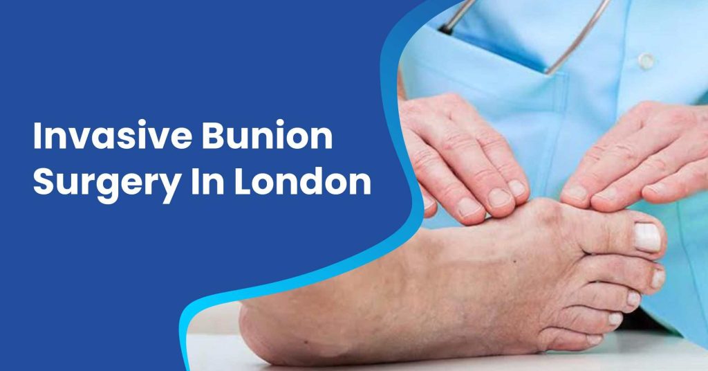 Invasive bunion surgery in London
