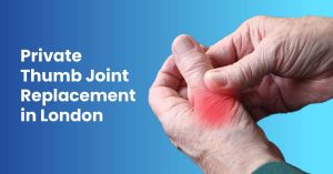 Private Thumb Joint Replacement in London