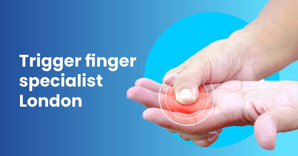Trigger Finger specialist in London